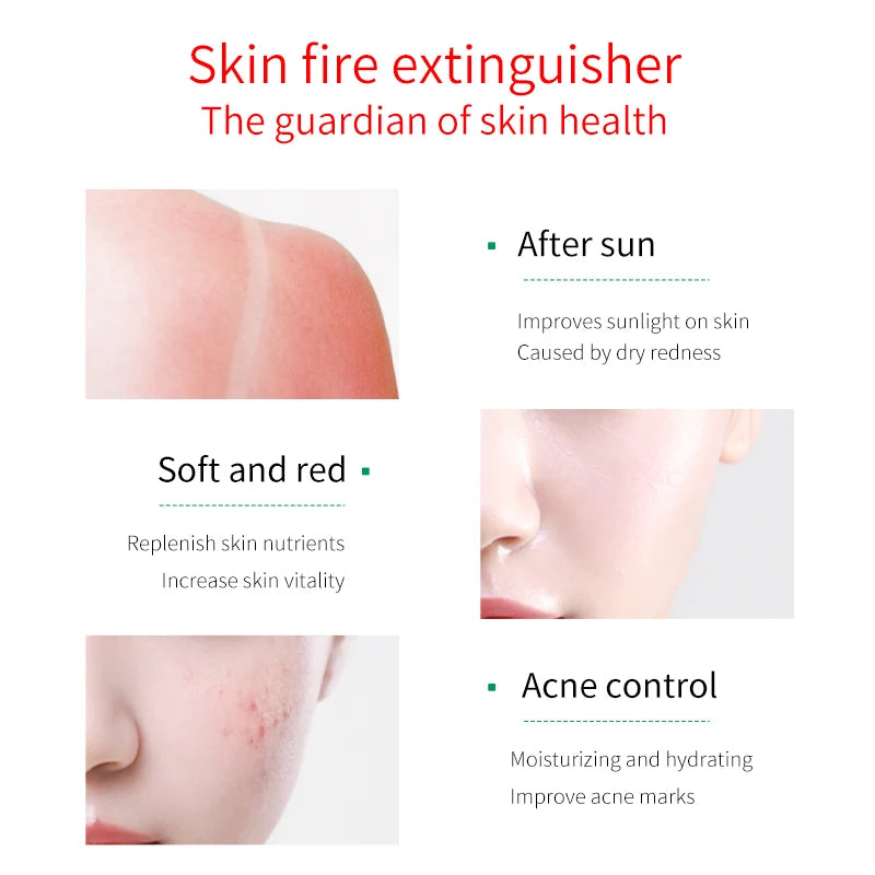 FONCE Organic Pure Aloe Vera Gel – 300g Moisturizing & Soothing Care