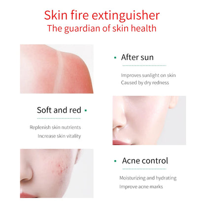 FONCE Organic Pure Aloe Vera Gel – 300g Moisturizing & Soothing Care