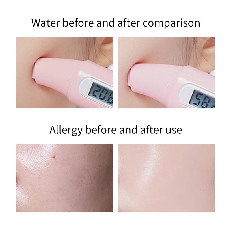 FONCE Organic Pure Aloe Vera Gel – 300g Moisturizing & Soothing Care